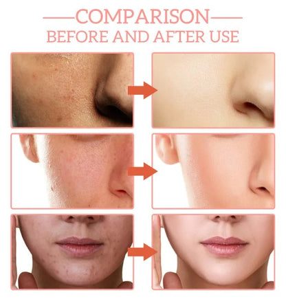 5-i-1 Uppstramande Ansiktsserum – Anti-Aging & Lyster